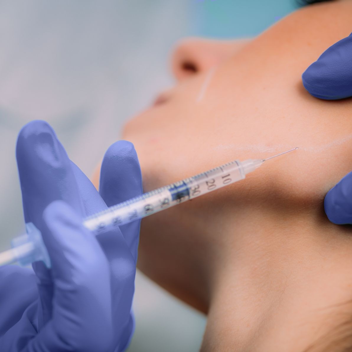 Chi phí tiêm botox gọn hàm tại Hbio Clinic