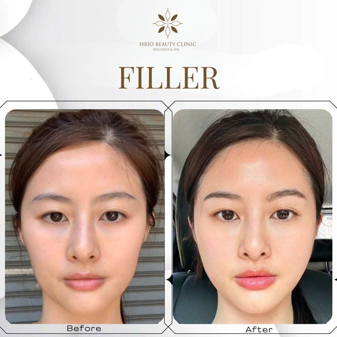 Kết quả ngay lập tức