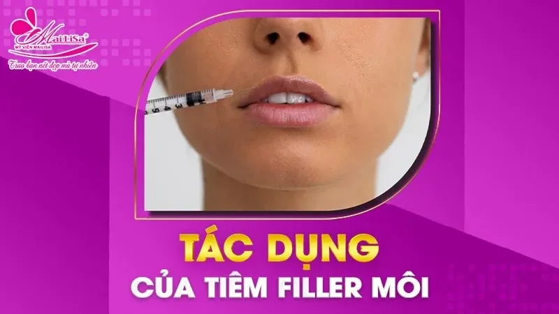 Benefits of lip filler injections