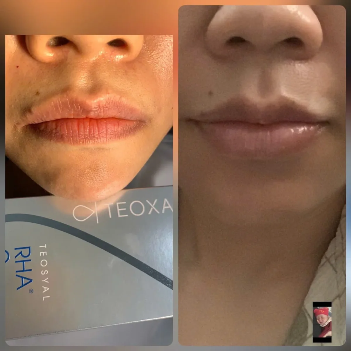 Create natural lip shapes