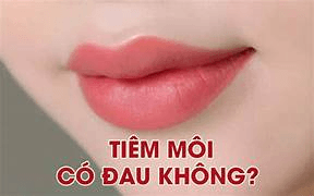Tiêm filler môi có đau không?