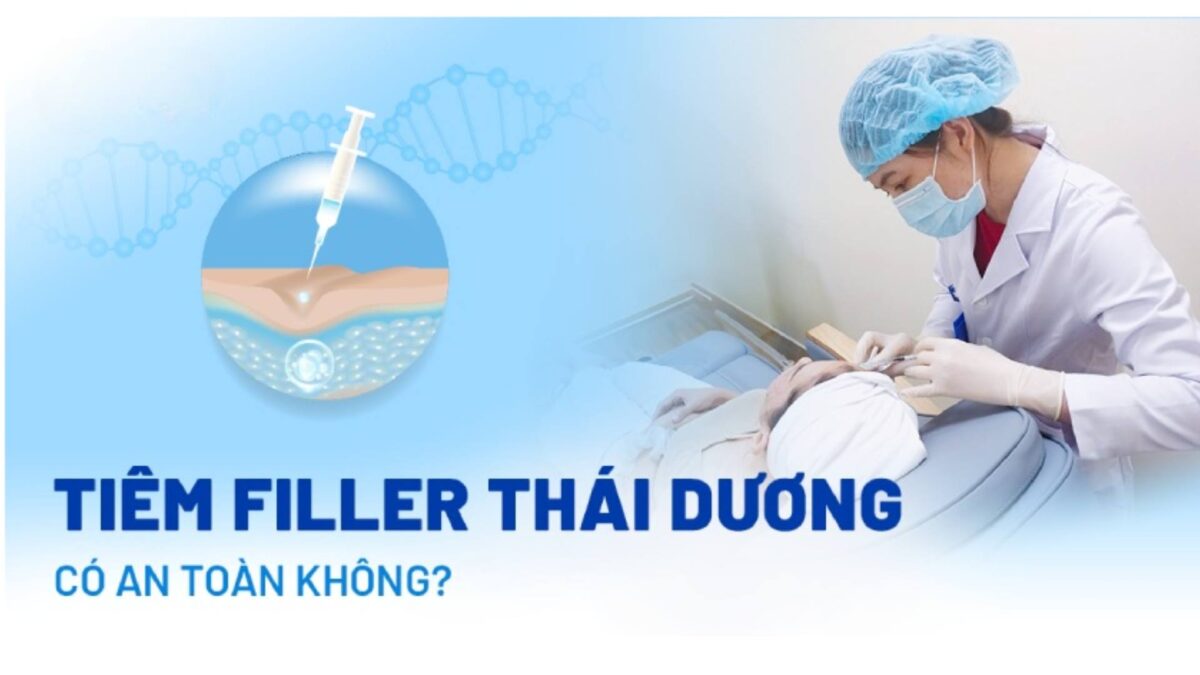tiêm filler thái dương là gì