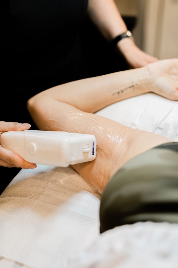 Triệt lông bằng diode laser có hiệu quả lâu dài