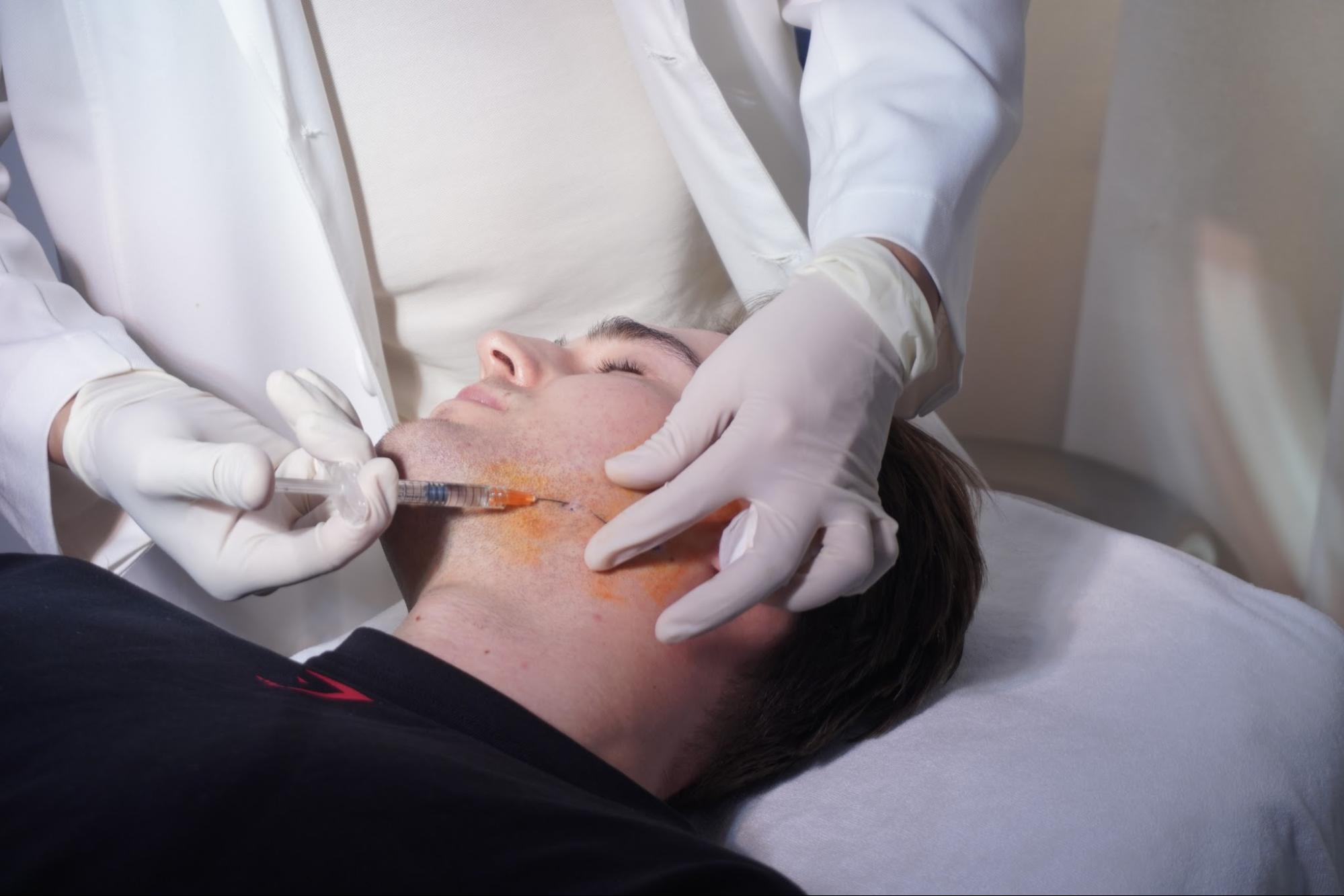 Tiêm filler tạo hình cằm V-line