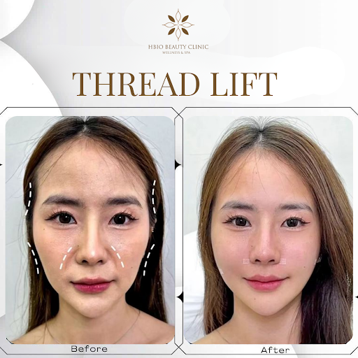 Không cần nghỉ dưỡng