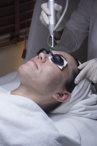 Tái tạo da bằng laser – Loại bỏ nếp nhăn và sắc tố không đồng đều