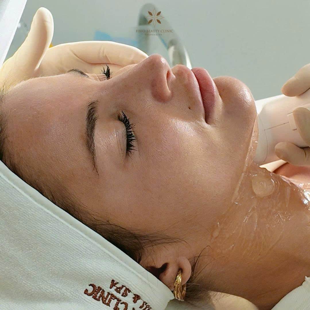 Quy trình điều trị bằng công nghệ hifu