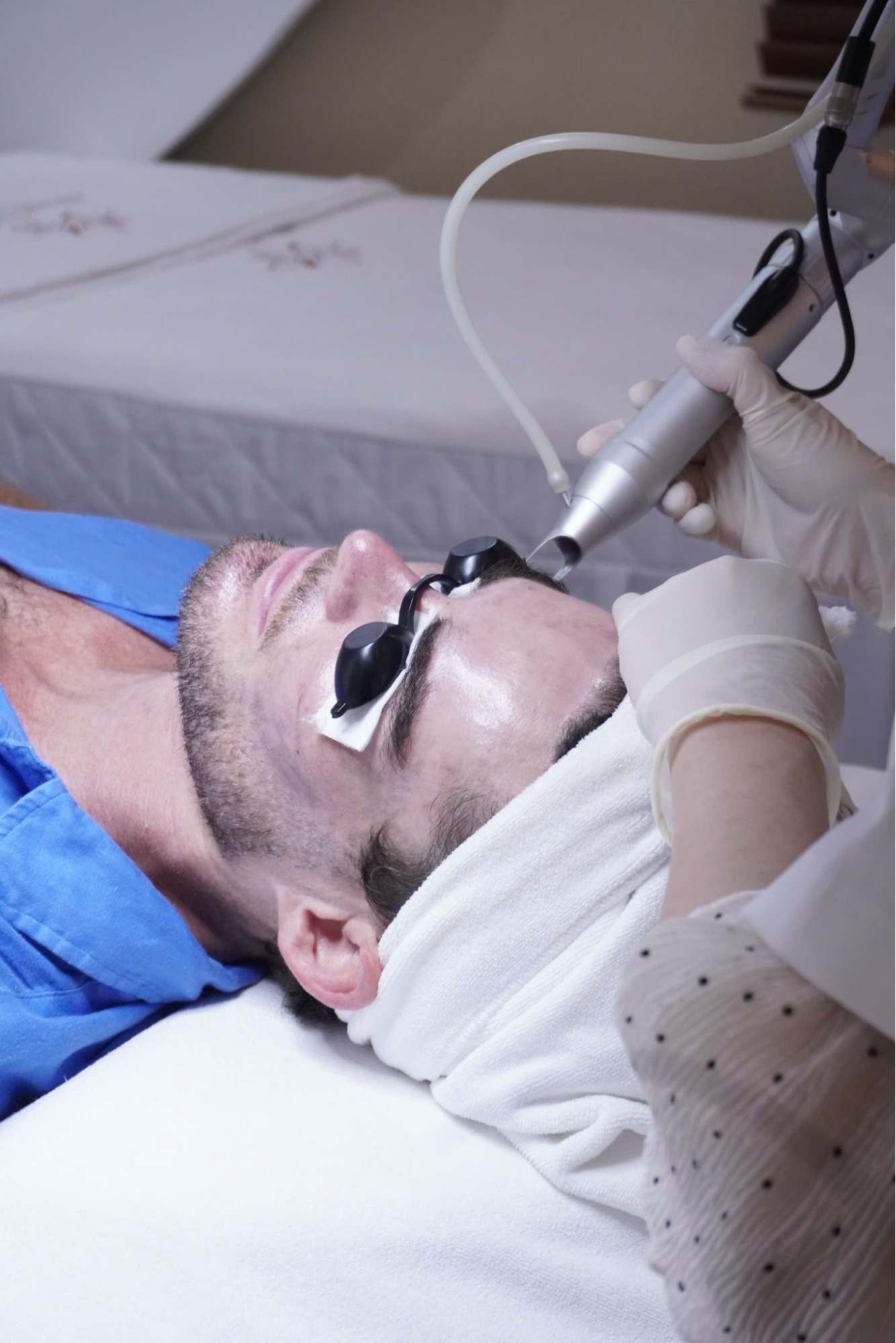 Điều trị tăng sắc tố bằng Laser