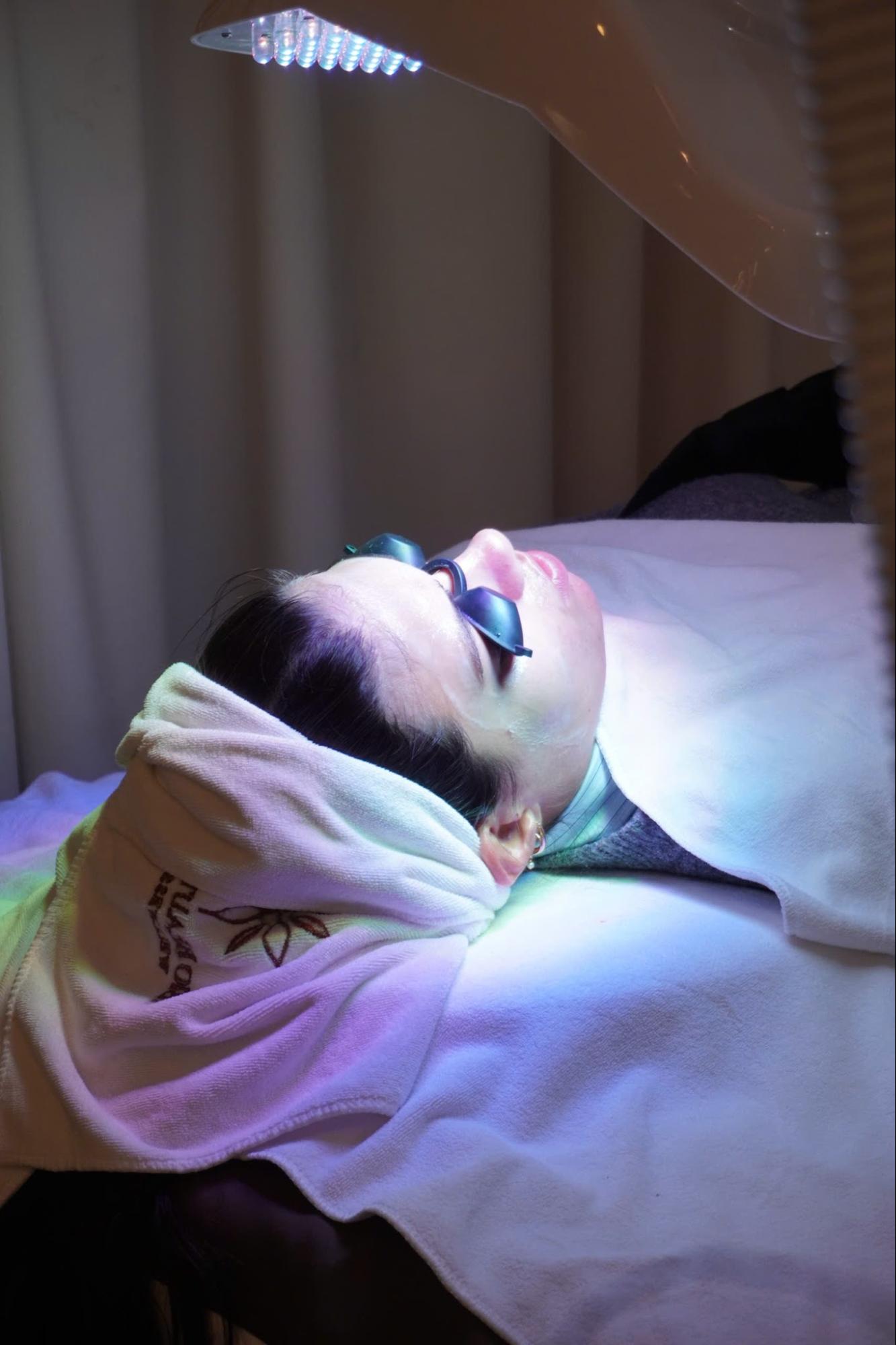 Liệu pháp ánh sáng (IPL) điều trị tăng sắc tố da