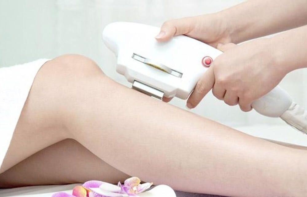 Triệt lông bằng Diode Laser là gì?