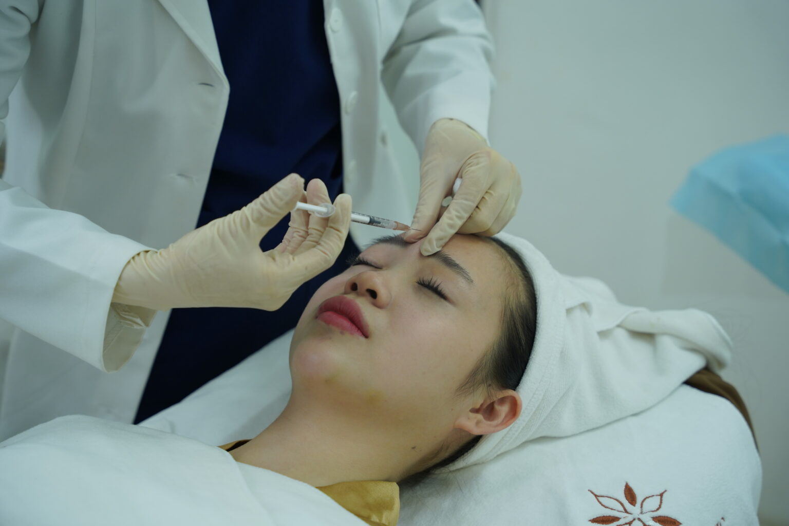 Ưu điểm vượt trội tiêm filler trán