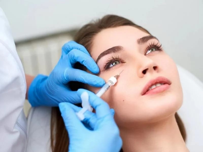 Ai nên tiêm filler hốc mắt?