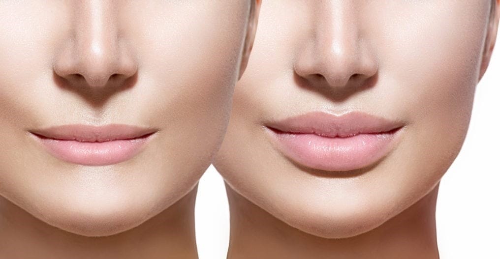 Lip care after filler injection and lip tattooing