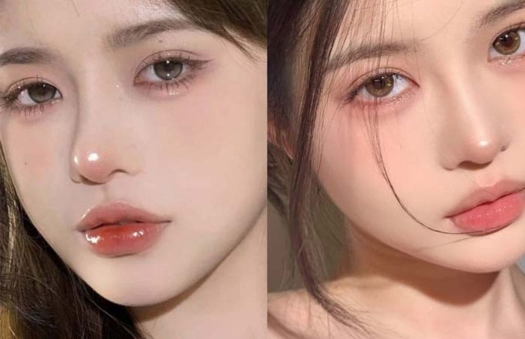 Chi phí tiêm bọng mắt cười là bao nhiêu?