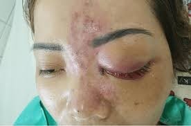 Cơ địa của người thực hiện