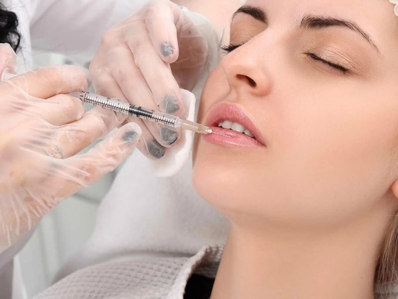 Dấu hiệu filler sắp tan là gì và filler bao lâu tan?