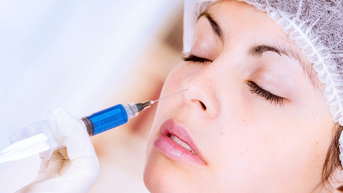 Dấu hiệu tiêm filler mũi bị tràn