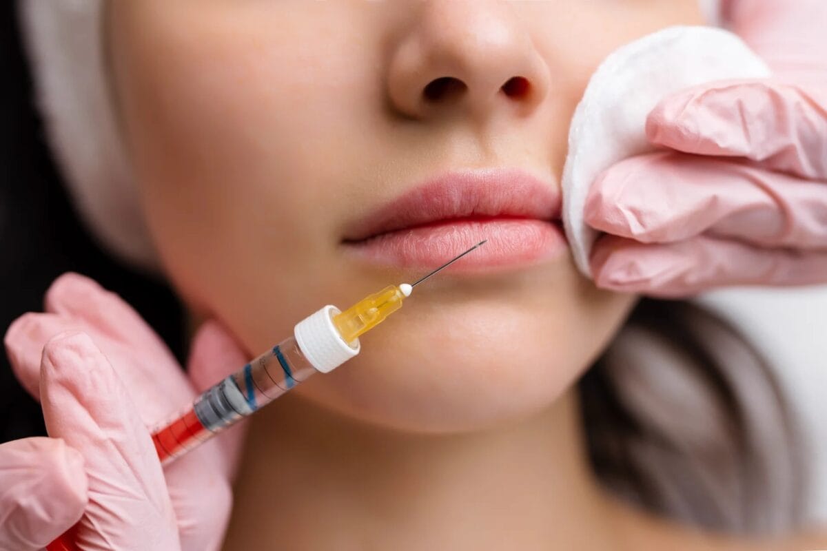 Địa chỉ tiêm filler uy tín, giá tốt - HBio