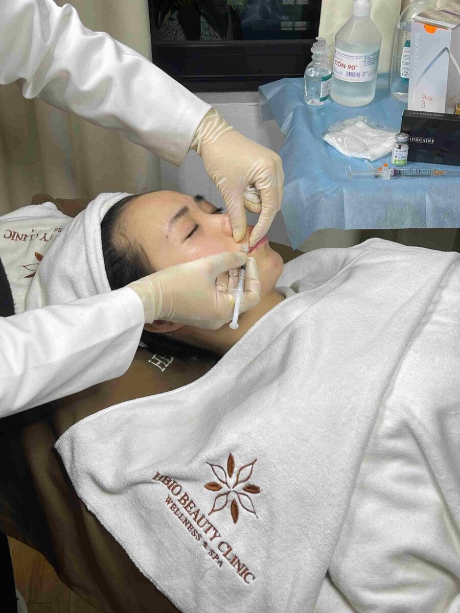 Đối tượng nào có thể tiêm filler?