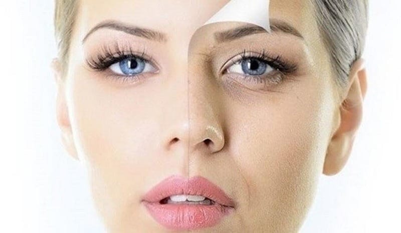 Những điều cần lưu ý khi tiêm làm đầy hốc mắt