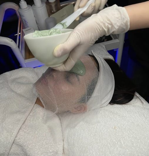 Peel da (Lột da hóa học)