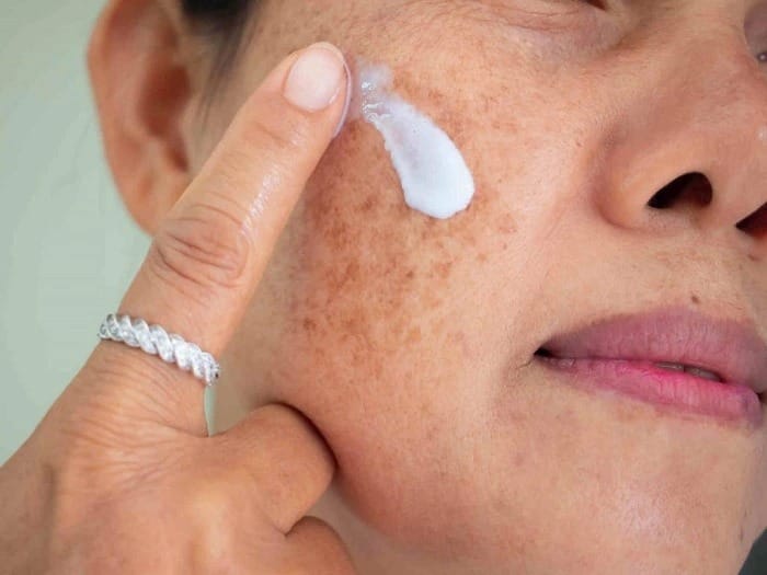 Sử dụng sản phẩm đặc trị
