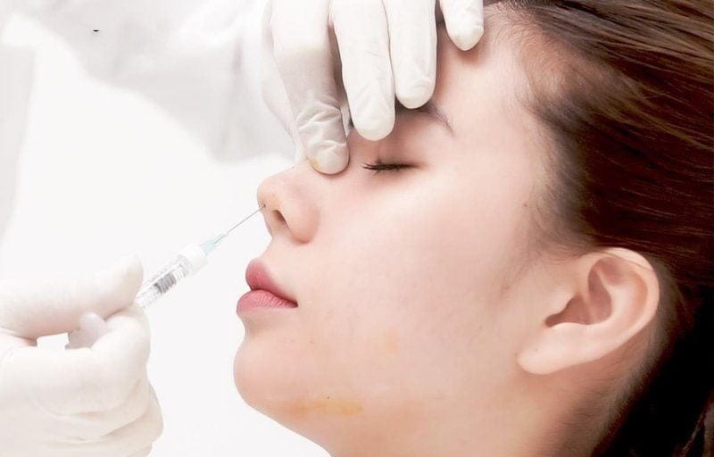 Thời gian duy trì của filler