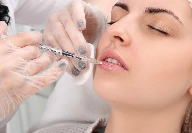 Tiêm filler giữ được bao lâu và filler là gì?