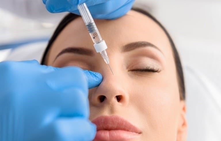 tiêm filler mũi bị tràn