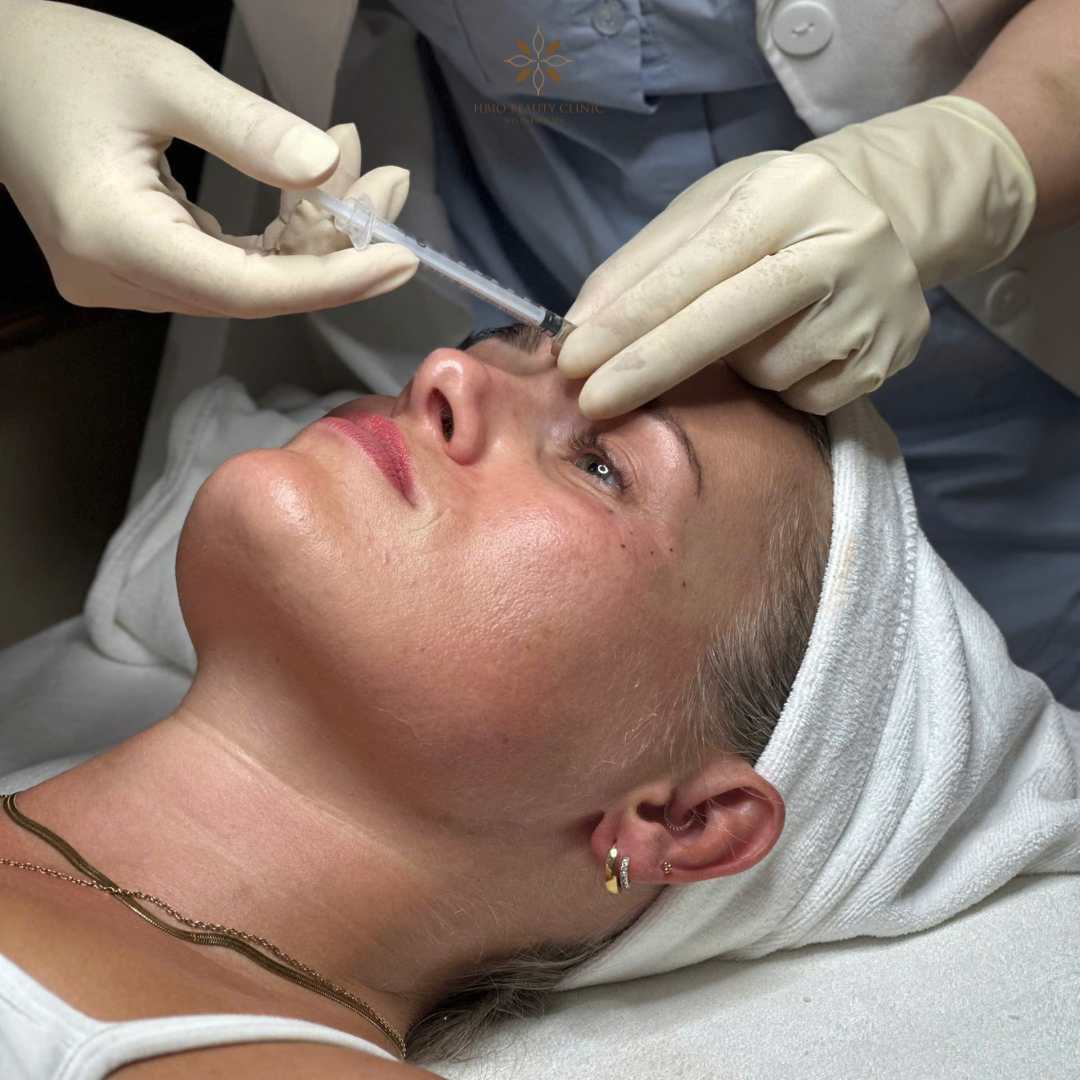 Tiêm Botox