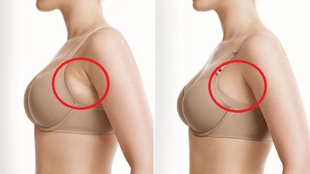 Áp dụng chế độ ăn uống khoa học