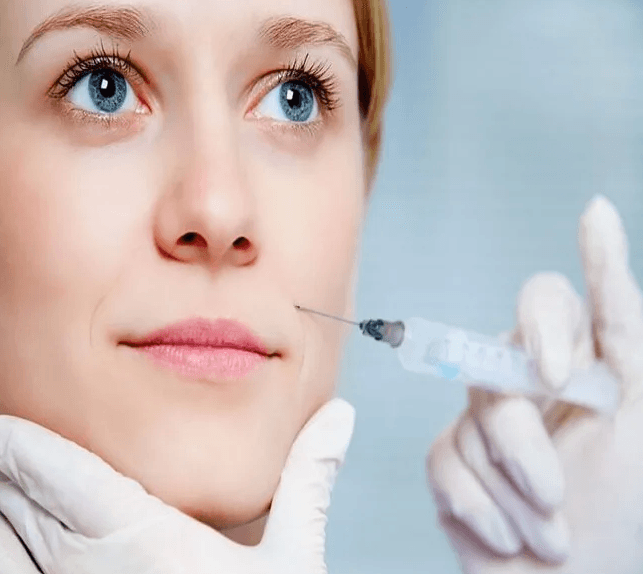 Cách giảm rãnh cười bằng kỹ thuật tiêm filler