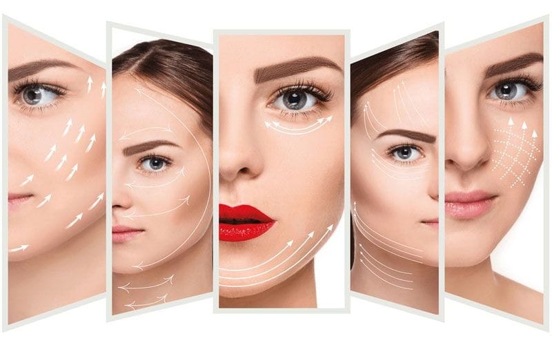Căng chỉ collagen giá bao nhiêu là hợp lý?