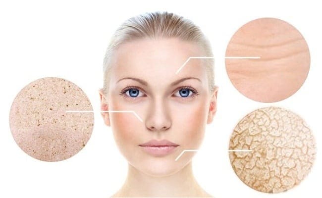 Chăm sóc da khô (Dry Skin)