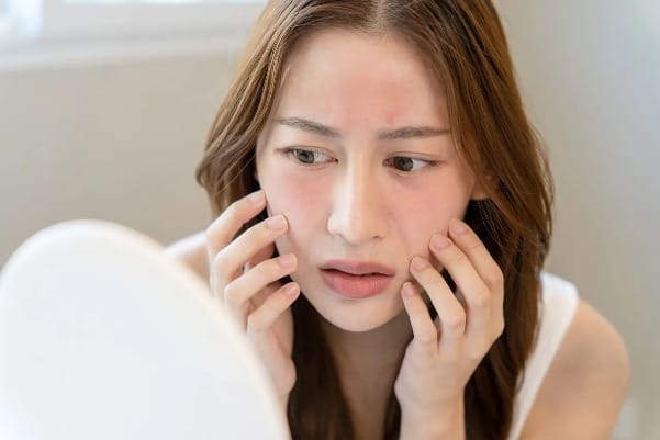 Chăm sóc da nhạy cảm (Sensitive Skin)