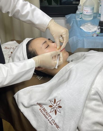 Chất làm đầy (Dermal Fillers)
