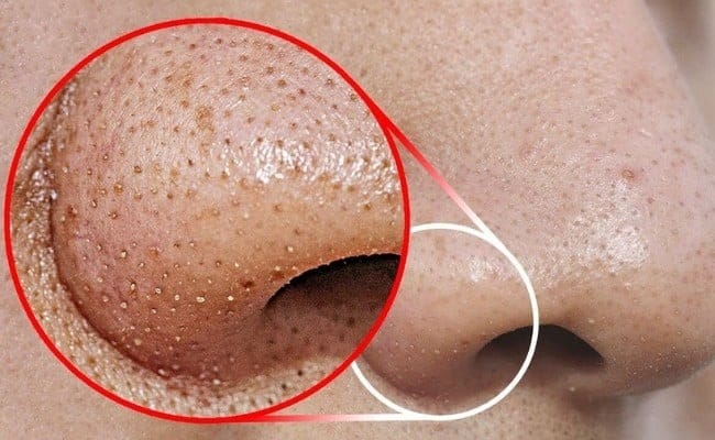Chế độ ăn uống không lành mạnh