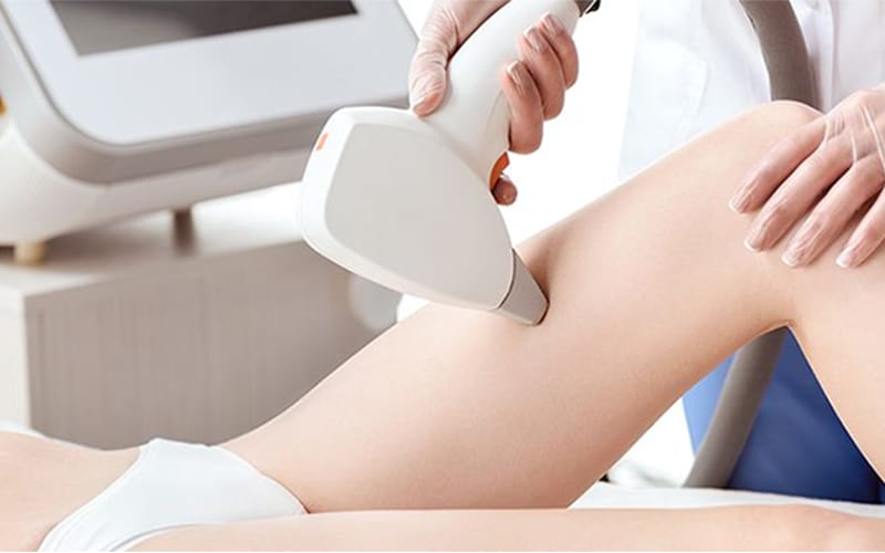 Công nghệ triệt lông Diode Laser tại HBIO Clinic
