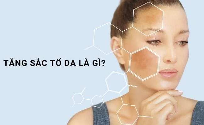 Da bị tăng sắc tố sau peel là gì?