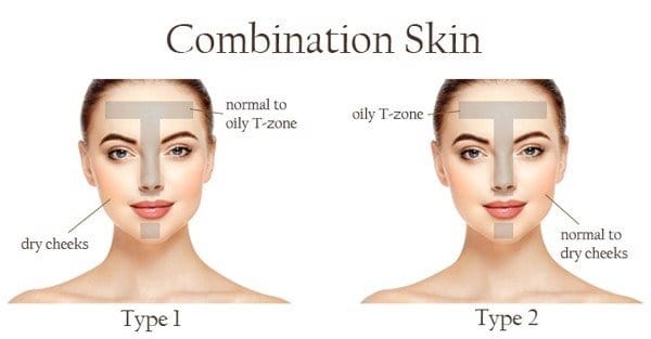 Da hỗn hợp (Combination Skin)