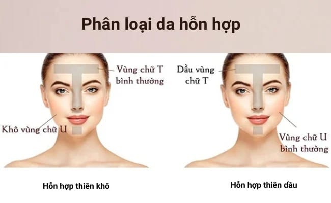 Đặc biệt lưu ý khi cấp ẩm cho da hỗn hợp