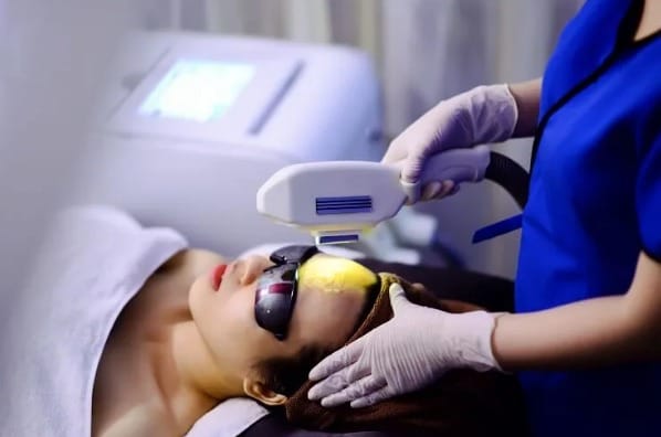 Điều trị mụn ẩn ở má bằng công nghệ laser
