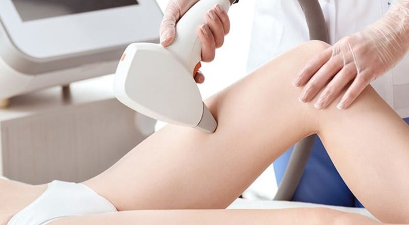 Giải pháp triệt lông bằng công nghệ diode laser tại HBIO Clinic