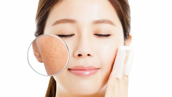 Hỗn hợp đường giúp thu nhỏ lỗ chân lông