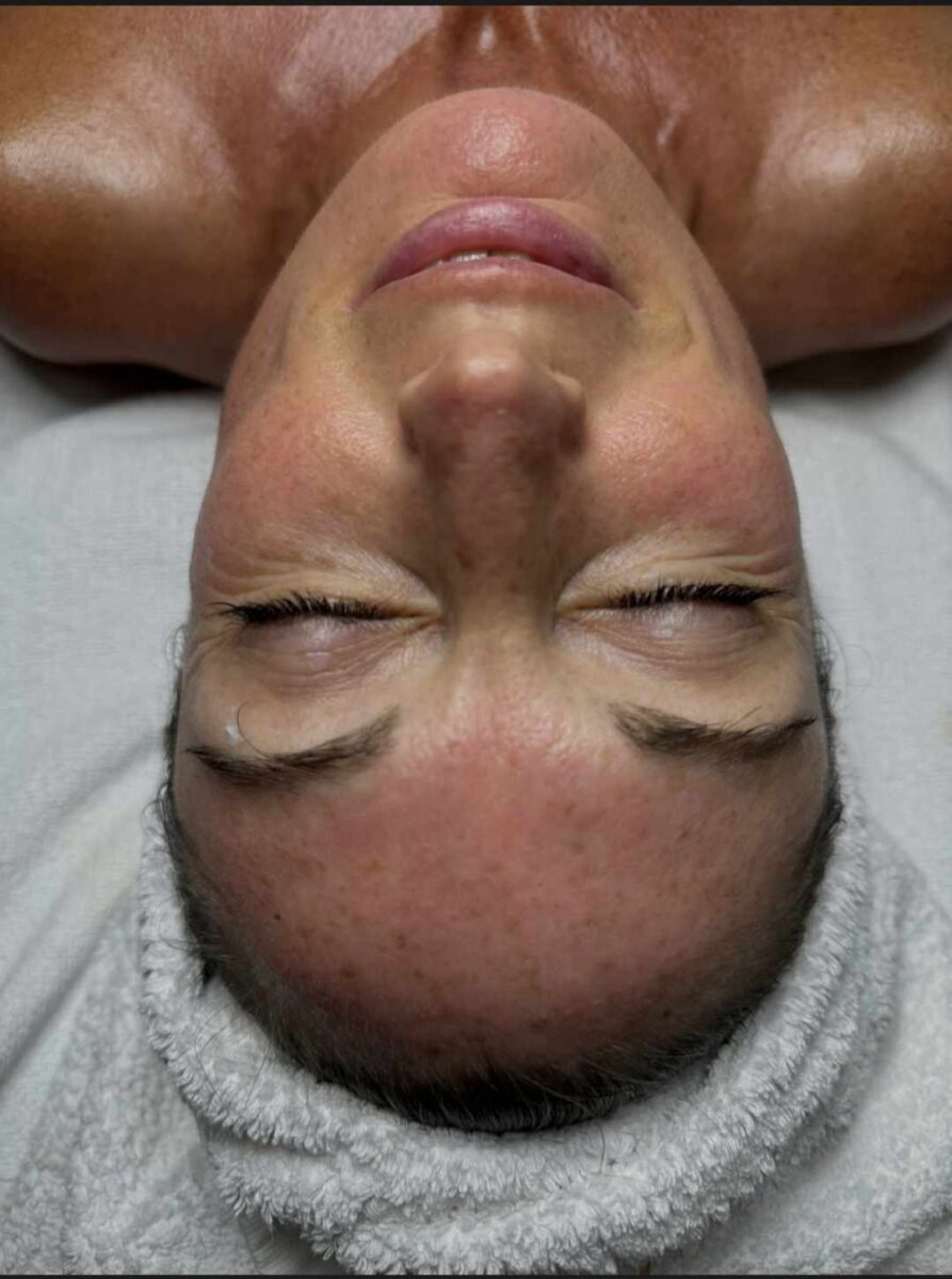 Hướng dẫn cách massage mắt đúng chuẩn