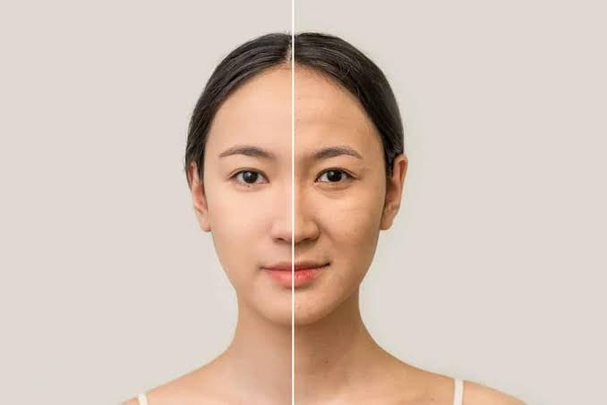 Nguyên nhân nào khiến da bị lão hoá