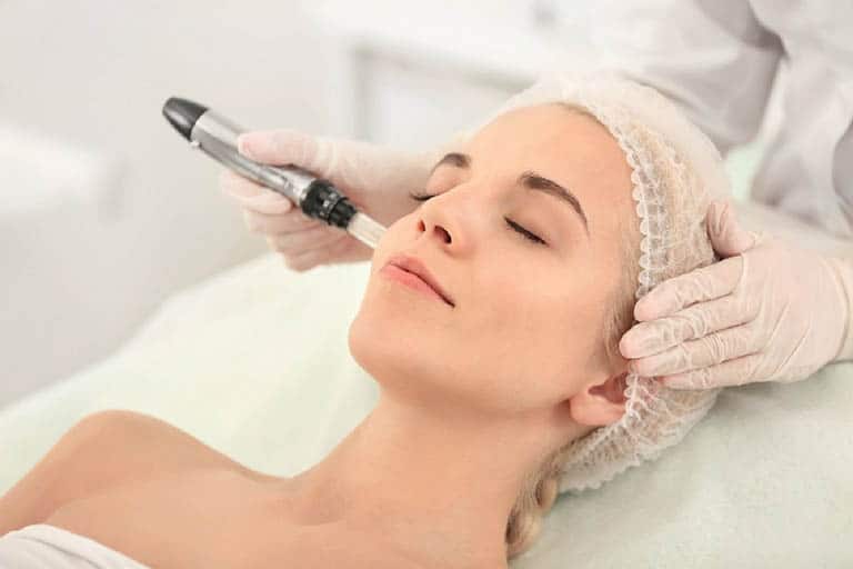 What Is Laser Melasma Treatment?