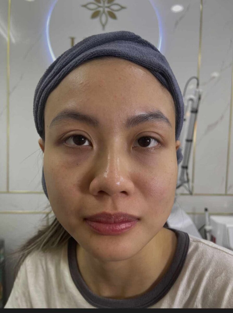 Massage mắt giúp lưu thông máu