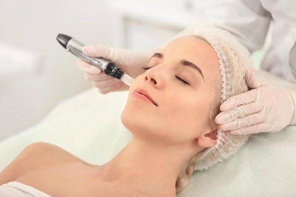 Microneedling – Kích thích tái tạo da, làm đầy nếp nhăn