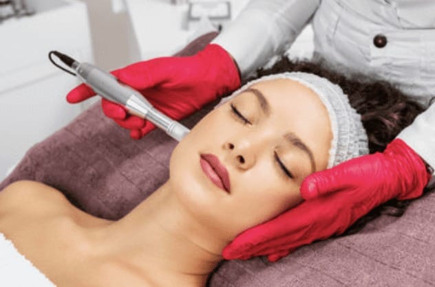 Microneedling là kỹ thuật sử dụng các cây kim siêu nhỏ